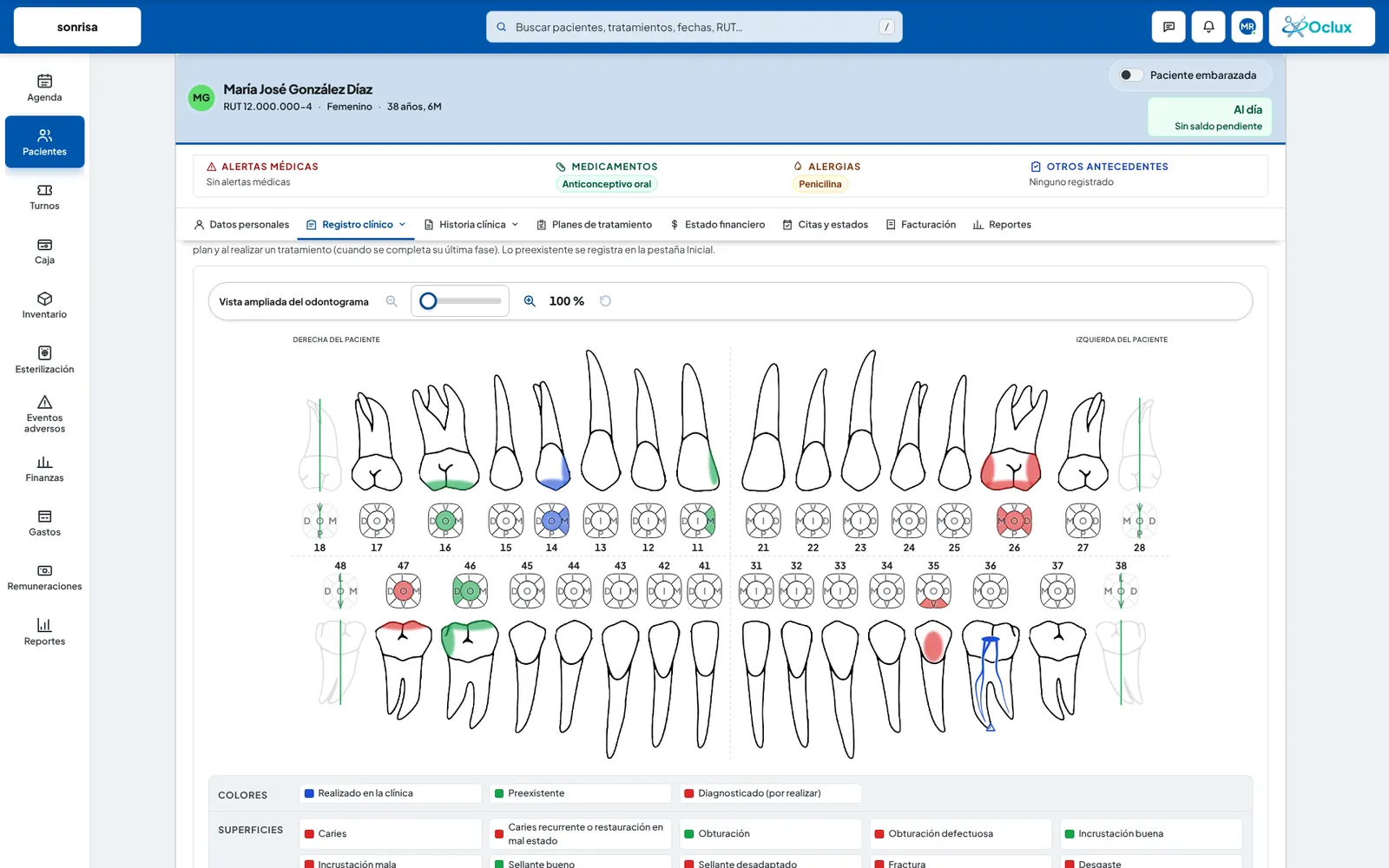 Oclux: ficha del paciente con odontograma y evoluciones